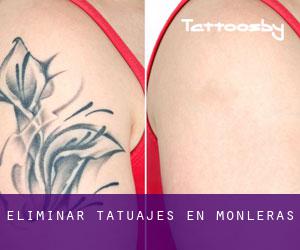 Eliminar tatuajes en Monleras