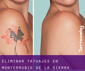 Eliminar tatuajes en Monterrubio de la Sierra